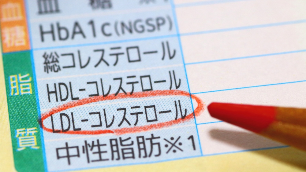 悪玉コレステロールの管理
